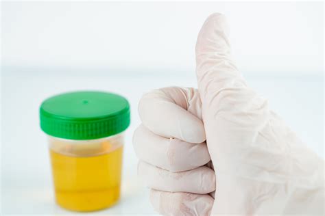 Urinalysis: Purposes, Types, Results .